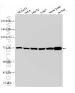 Methylmalonyl Coenzyme A mutase/MUT Recombinant monoclonal antibody proteintech 84879-5-RR