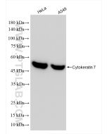 Cytokeratin 7 Recombinant monoclonal antibody proteintech 86153-7-RR