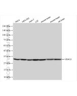 VDAC2 Recombinant monoclonal antibody Proteintech  84225-2-RR