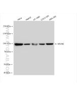 NSUN2 Recombinant monoclonal antibody proteintech 82894-7-RR