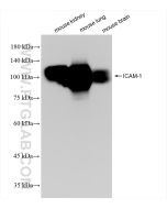 ICAM-1/CD54 Recombinant monoclonal antibody proteintech 82827-8-RR
