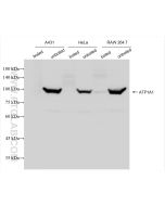 ATP1A1 Recombinant monoclonal antibody proteintech 83191-6-RR
