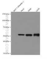 Vimentin Recombinant monoclonal antibody proteintech 80232-1-RR