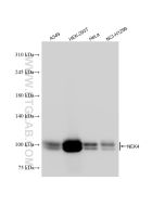 NEK4 Recombinant monoclonal antibody proteintech 84654-4-RR