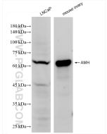 AMH Recombinant monoclonal antibody proteintech 84153-5-RR