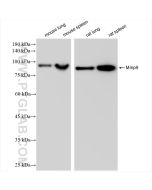 Mmp9 Recombinant monoclonal antibody proteintech 83768-3-RR