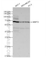 MMP13 Recombinant monoclonal antibody proteintech 83188-4-RR