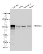 PPP1R15B Recombinant monoclonal antibody proteintech 83016-6-RR