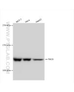 TBCD Recombinant monoclonal antibody proteintech 82911-7-RR