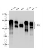 Integrin Beta 1/CD29 Recombinant monoclonal antibody proteintech 82729-3-RR