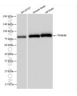 TRIM46 Recombinant monoclonal antibody proteintech 83614-2-RR