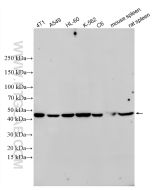 TGF Beta 1 Recombinant monoclonal antibody proteintech 81746-2-RR
