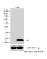 IL-2 Recombinant monoclonal antibody proteintech 83558-5-RR
