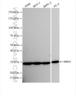 SNAI1 Recombinant monoclonal antibody proteintech 81584-5-RR