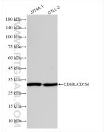 CD40L/CD154 Recombinant monoclonal antibody proteintech 83884-3-RR
