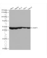 DGAT1 Recombinant monoclonal antibody proteintech 82945-1-RR