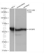 IGF2BP2 Recombinant monoclonal antibody proteintech 82757-2-RR