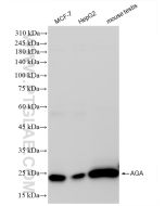 AGA Recombinant monoclonal antibody proteintech 83442-6-RR