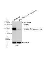 CD141/Thrombomodulin Recombinant monoclonal antibody proteintech 83416-4-RR