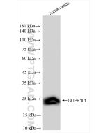 GLIPR1L1 Recombinant monoclonal antibody proteintech 83584-3-RR