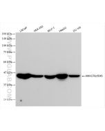 AMACR/p504S Recombinant monoclonal antibody proteintech 84891-2-RR