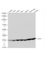 ATAD1 Recombinant monoclonal antibody proteintech 84194-6-RR
