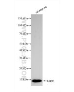 Leptin Recombinant monoclonal antibody proteintech 83655-3-RR