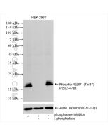 Phospho-4EBP1 (Thr37) Recombinant monoclonal antibody proteintech 81812-4-RR