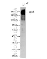 CORIN Recombinant monoclonal antibody proteintech 83566-1-RR