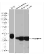 Synaptophysin Recombinant monoclonal antibody proteintech 82900-1-RR