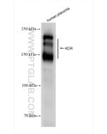 VEGFR2/CD309 Recombinant monoclonal antibody proteintech 83049-4-RR