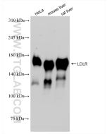 LDLR Recombinant monoclonal antibody proteintech 82724-1-RR