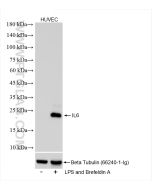 IL-6 Recombinant monoclonal antibody proteintech 83747-5-RR