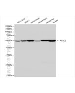 ACAD9 Recombinant monoclonal antibody proteintech 84202-1-RR