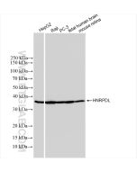 HNRPDL Recombinant monoclonal antibody proteintech 83129-5-RR