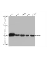 NSUN2 Recombinant monoclonal antibody proteintech 82894-2-RR