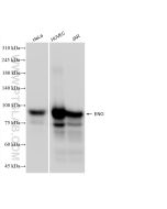 Endoglin/CD105 Recombinant monoclonal antibody proteintech 82993-6-RR