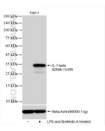 IL-1 beta Recombinant monoclonal antibody proteintech 82696-15-RR