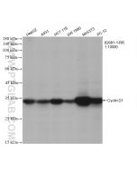 Cyclin D1 Recombinant monoclonal antibody proteintech 82681-1-RR