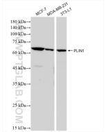 Perilipin 1 Recombinant monoclonal antibody proteintech 83905-4-RR