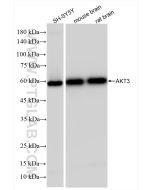 AKT3 Recombinant monoclonal antibody proteintech 85769-4-RR
