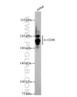 CD45 Recombinant monoclonal antibody proteintech 84405-6-RR