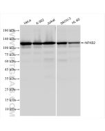 NFKB2,p100 Recombinant monoclonal antibody proteintech 84022-6-RR