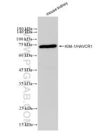 KIM-1/HAVCR1 Recombinant monoclonal antibody proteintech 83221-2-RR