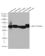 Alpha-1-Antitrypsin Recombinant monoclonal antibody proteintech 82918-1-RR