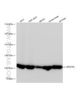 NPEPPS Recombinant monoclonal antibody proteintech 84230-5-RR