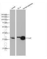 LAT Recombinant monoclonal antibody proteintech 82901-1-RR