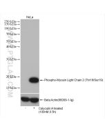 Phospho-Myosin Light Chain 2 (Thr18/Ser19) Recombinant monoclonal antibody proteintech 82717-1-RR