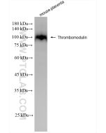 CD141/Thrombomodulin Recombinant monoclonal antibody proteintech 84412-3-RR