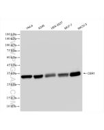 CBR1 Recombinant monoclonal antibody proteintech 83736-4-RR